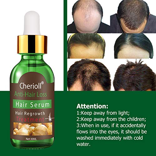 Hair Serum, Anti Pérdida de Pelo,Sérum Para Crecimiento del Cabello, Suero Para el Pelo, Crecimiento Cabello Estimula El Crecimiento De Pelo Para Hombres Y Mujeres