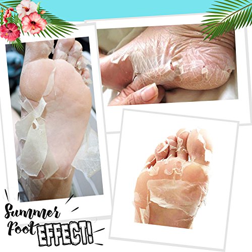 Summer Foot mascarilla exfoliación de pies, elimina callos, cutículas y piel muerta, exfoliante e hidratante, máscara peel off, calcetines exfoliantes de pies, foot peeling mask, peeling pies