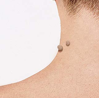 BEST DIRECT Skin Tag Patch Elimina las Etiquetas de la Piel Fórmula salicílico Tratamiento natural Indoloro Testado dermatológicamente - 30 Parches