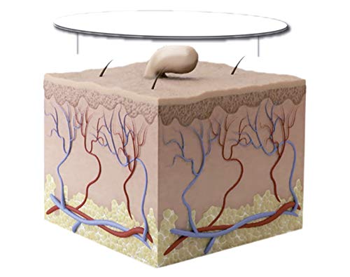 BEST DIRECT Skin Tag Patch Elimina las Etiquetas de la Piel Fórmula salicílico Tratamiento natural Indoloro Testado dermatológicamente - 30 Parches