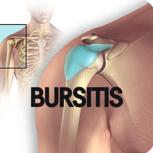 Bursitis Disease