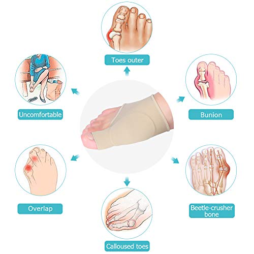 Protector de Juanete Dedo Gordo, Corrector Dedo Martillo, Corrector Juanete Hallux Valgus, Corrector Juanetes Diurno para Alivio del Dolor y Dedo en Martillo, 1 Par