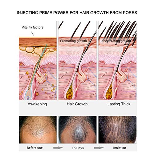 Aceite para Crecimiento del Cabello, Pelo profesional Corrector para adelgazamiento del cabello Aerosol para el cabello con aplicador de spray para la bombapara mujeres y hombres