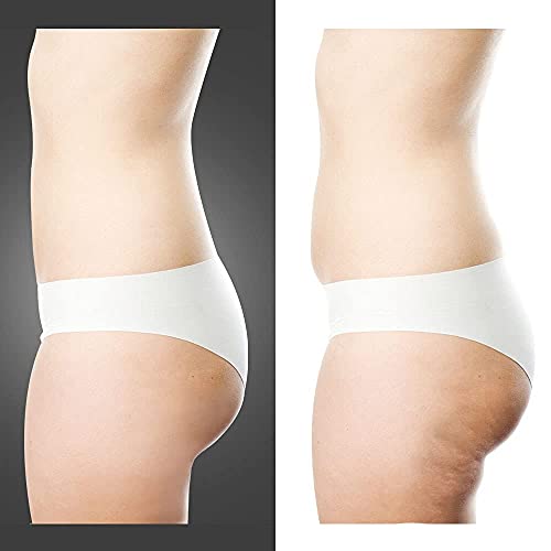 Gridinlux | Cavitación y Radiofrecuencia Corporal Ultrasónica | 3 Modos | Terapia de Luz Led | Masaje Térmico | Limpieza Profunda, Efecto Lifting | Elimina Grasa, Celulitis y Reafirma la Piel