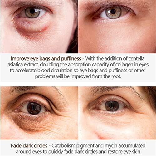 Magic Eye Cream to Remove Eye Bags Dark Circles Anti-Wrinkle And Firming Eye Cream Eye Wrinkles Vibrant Glamour Magic Anti-age Eye Cream (50g)