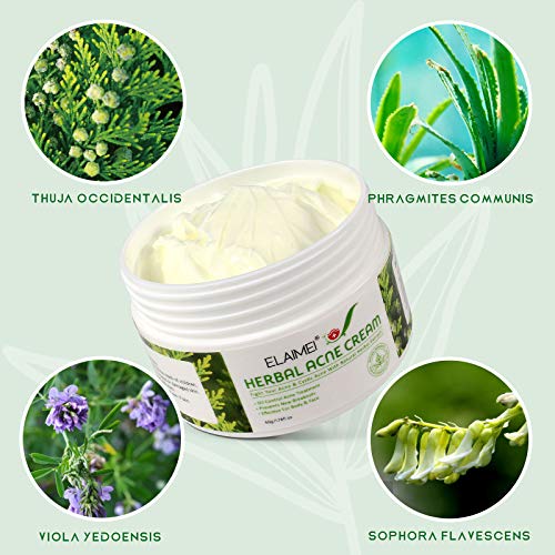 Herbal Acne Cream, Crema Antiespinillas, Crema Antiacné, Acné Tratamiento, Equilibrar el Agua y el Aceite, Elimina las Manchas de la Piel, Efectivo para Cuerpo y Rostro - 50g