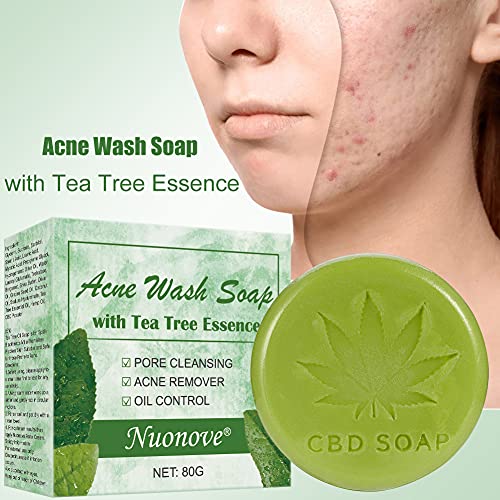 Jabón Facial Jabon Acne Jabón de Aceite de Arbol de té, Jabón Hecho a Mano Orgánico Natural Puro, Antibacteriano, Tratamiento Eficaz Del Acné, Elimina los Puntos Negros, 80g