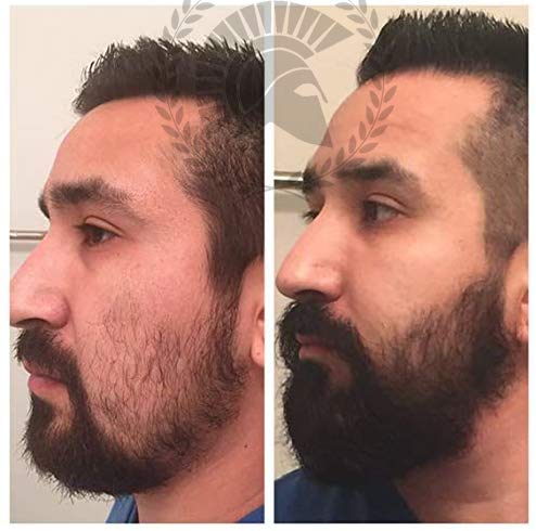 Nuevo en Amazon! Super Kit Incenvador de Crecimiento para Barba. 95% de efectividad. 100% orgánico. Envío en 24 horas. Productos más vendidos para el crecimiento de la barba en España 2019!