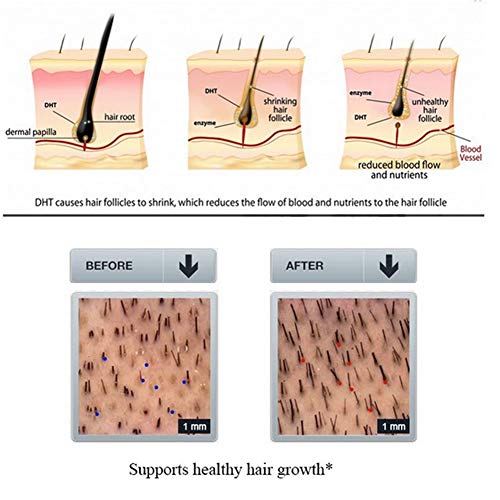 Venta loca Sin Aceite de Silicona Tratamiento para la pérdida del Cabello Champú y acondicionador para el Crecimiento del Cabello de Jengibre Cuidado nutritivo del Cabello