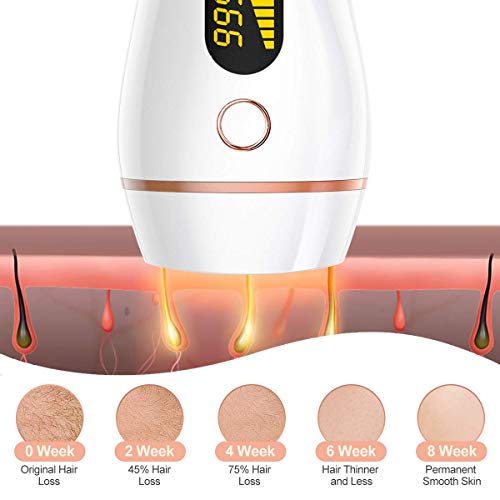 ZumYu Depiladora de Luz Pulsada IPL 999,999 Flashes, Depiladora Mujer Permanente sin Dolor, 2 Modos & 5 Niveles de Energía Sistema de Depilación para Cara, Axilas, Brazos, Espalda y Pierna