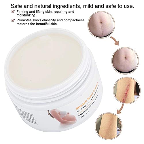 120g Crema Antiestrias Embarazo, Crema para las estrías, Eliminar las estrías, Eliminar Cicatrices del Embarazo, Reparar cicatriz Línea floja Abdomen Estrías para posparto