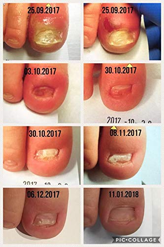 Arkada Serum TC16 Tratamiento Inmediato de Cara Cuerpo Y Piel Acné Arrugas Hongos Infecciones Quemaduras etc