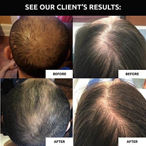 DS Laboratories Revita COR crecimiento del pelo Acondicionador Estimulante, 31.3 onza