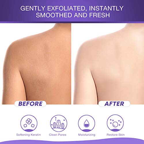 Exfoliante Corporal De Lavanda, Sal Del Mar Muerto Orgánico Natural, Antienvejecimiento Y Exfoliación, Mejora La Celulitis, Cicatrices De Acné, Arañas Vasculares, Estrías, Líneas Finas Y Arrugas