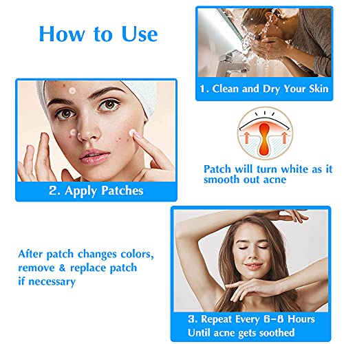 Parches de acné, 216 piezas invisibles hidrocoloides absorbentes parches de acné, tratamientos de acné, parches de acné, parches de curación para el acné facial, tratamiento del acné cuidado del acné