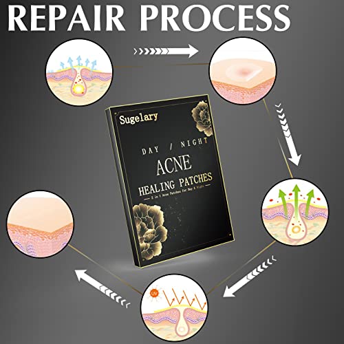 252 PCS Parches Para Acné, Uso Diurno y Nocturno, Parches Hidrocoloides Para el Acné 2 en 1Parches Maestros de Espinillas Hidrocoloides Invisibles Ultrafinos Para el Tratamiento del Acné Facial