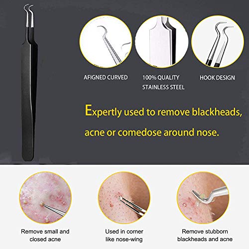 【5 piezas】Extractor de Puntos Negros Kit, Herramientas para eliminar puntos negros de Acné para Quita Espinillas Granos Comedones, Profesional Para Tratamiento de Puntos Negros