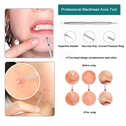 6 piezas Kit Blackhead Remover,Extractor de Acné Eliminación Puntos Negros para la Piel Facial,Quita Espinillas Negros Comedones Herramientas