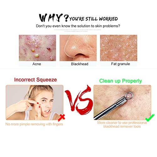 6 piezas Kit Blackhead Remover,Extractor de Acné Eliminación Puntos Negros para la Piel Facial,Quita Espinillas Negros Comedones Herramientas