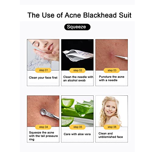 6 piezas Kit Blackhead Remover,Extractor de Acné Eliminación Puntos Negros para la Piel Facial,Quita Espinillas Negros Comedones Herramientas