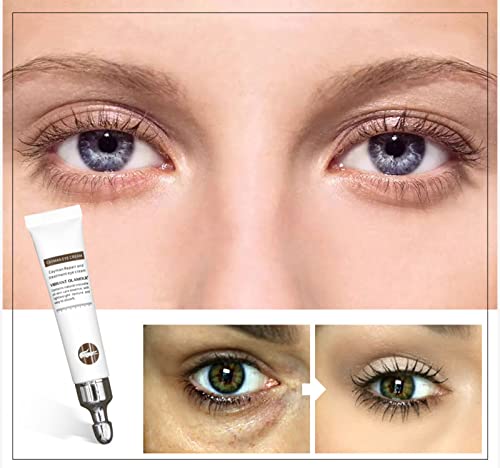 60g Magic Eye Cream, Magic Wrinkle Eye Cream, Anti Age Eye Cream, Remove Eye Bags Dark Circles Anti-wrinkle and Firming Eye Cream (60g)