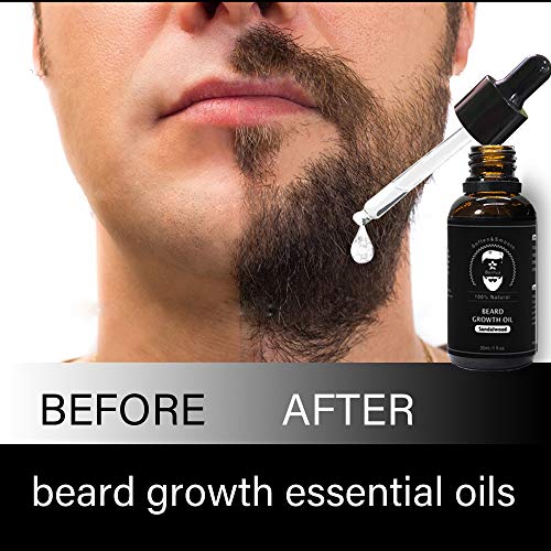 Aceite de crecimiento de barba, natural orgánico para el crecimiento del cabello, aceite para barba (30 ml)