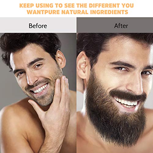 Aceite Para Barba Crecimiento,Jane Choi Aceite Para Barba Hombre,RáPidamente Crecimiento De La Barba Corta Cuidado Barba,Calmante,Hidratante, 50ml Natural Aceite Para Barba Activador Regalos Hombre
