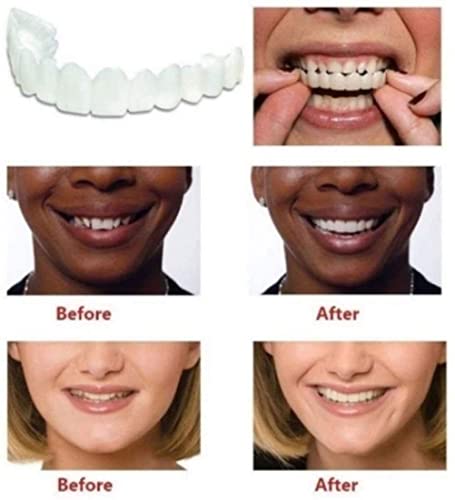 AMPQON Dientes Dentadura Sonrisa Diente Falso Carillas instantáneas Dentaduras Dientes Relleno Temporal cosmético Kits de blanqueamiento Kit de Relleno de Dientes Permanente (Superior + Inferior) Un