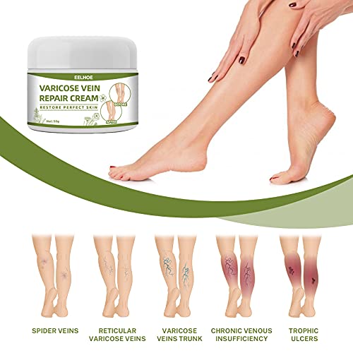 Bakermiche Crema de Varices Crema de reparación de piernas de araña Crema para vasculares Alivio de la angitis por flebitis para Las piernas Crema calmante para Las piernas Circulacion Piernas