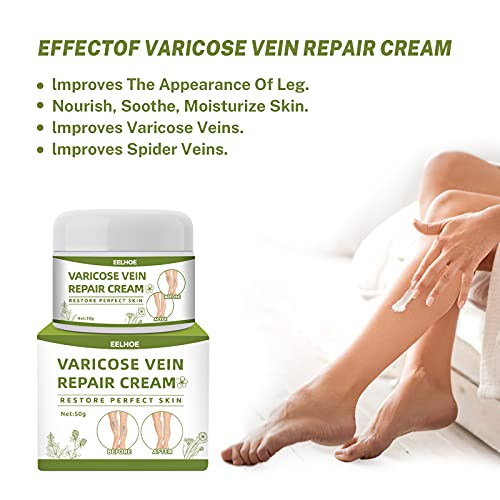 Bakermiche Crema de Varices Crema de reparación de piernas de araña Crema para vasculares Alivio de la angitis por flebitis para Las piernas Crema calmante para Las piernas Circulacion Piernas