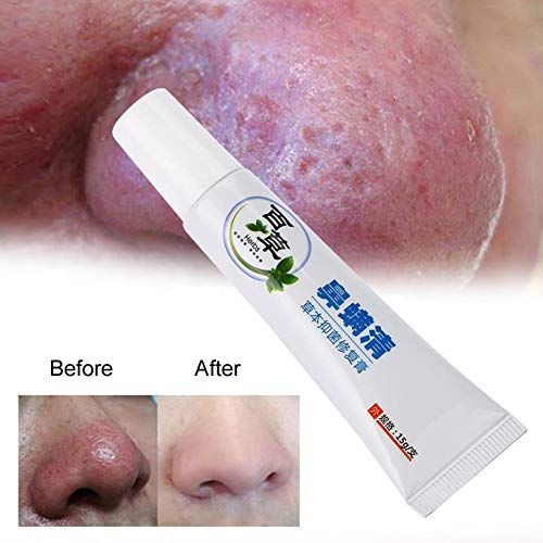 Bestt Crema Tratamiento De Rosácea - 15 G
