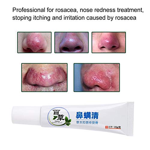 Bestt Crema Tratamiento De Rosácea - 15 G