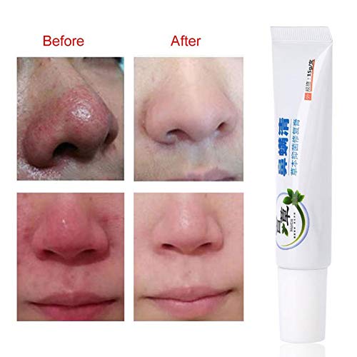 Bestt Crema Tratamiento De Rosácea - 15 G