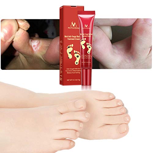Bulary Herb Antihongos Beriberi Crema de tratamiento Crema para el cuidado de los pies Ampollas Peeling Beriberi Pies pomadas Ungüento