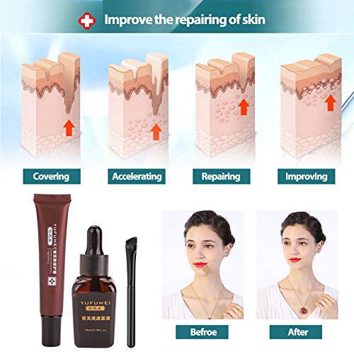 Corrector, vitíligo profesional, tapa, juego de líquidos, cicatriz, tatuaje, corrector, escondido, manchas, marcas de nacimiento, por Filfeel
