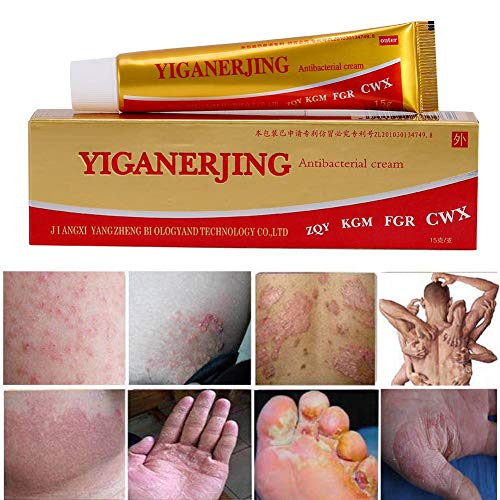Crema de psoriasis para el tratamiento del eccema natural de 15 g, humectante suave natural orgánico para pieles sensibles con tendencia a la costra láctea (dermatitis seborreica infantil), erupciones