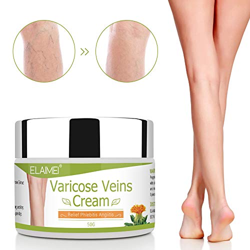 Crema de venas varicosas, tratamiento de venas varicosas, crema de tratamiento de venas de araña para piernas, mejora la circulación sanguínea, piernas cansadas y pesadas alivio rápido