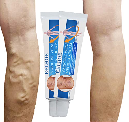 Crema para venas varicosas, crema para el cuidado de la hinchazón de las piernas, crema para reparar las piernas de araña, crema para el tratamiento de las venas varicosas (2PCS)