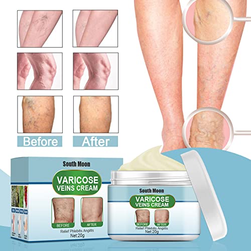 Crema reparadora de venas de araña Beauskin, crema para venas varicosas, crema reparadora de piernas de araña, crema para el tratamiento de venas varicosas, mejora la apariencia de las piernas (3pcs)