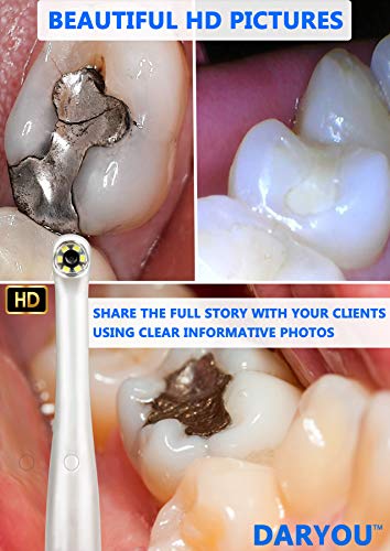 DARYOU Cámara intraoral DY-60 720P HD 4X Zoomable Super Clear Dental Camera.Button Realmente Funciona en Examine Pro, LOGOsw, DBSwin, Vixwin, Eaglesoft Dexis More Garantía de reemplazo de 1 año