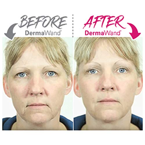 Dispositivo DermaWand Pro, microcorriente para el cuidado de la piel, la solución antienvejecimiento para todos los tipos de piel.