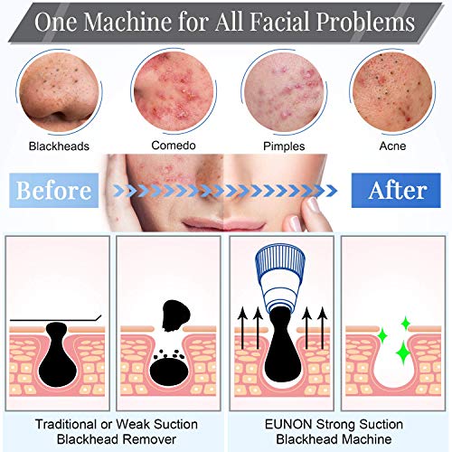 EUNON Limpiador de Poros Succionador de Puntos Negros Limpiador Facial Blackhead Remover Extractor Puntos Negros USB Recargable con Pantalla Grande 4 Cabezales