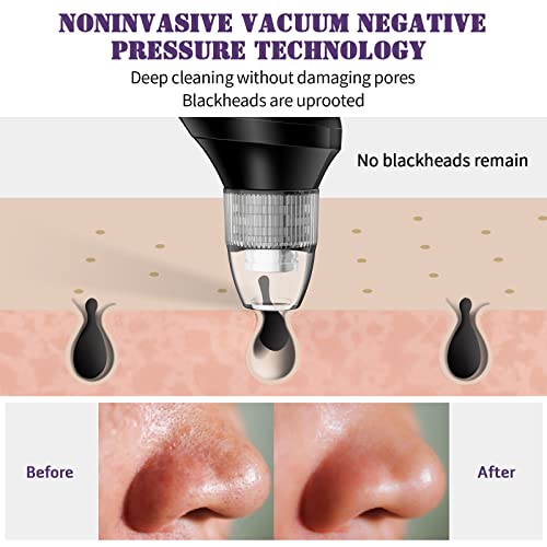 EUNON Limpiador de Poros Succionador de Puntos Negros Limpiador Facial Blackhead Remover Extractor Puntos Negros USB Recargable con Pantalla LED 4 Cabezales y 5 Modos para Espinillas y Acné Suciedad