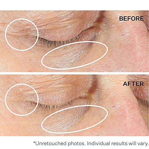 Intensive Eye Concentrate For Wrinkles 30 Ml
