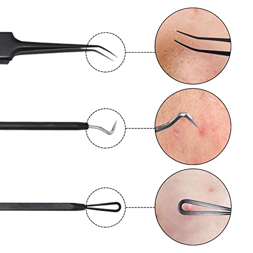 Justmysport Extractor de Puntos Negros Aguja Exacdor Limpiador Juego de 11 piezas Herramientas para Remover Acné Comedones BlackHead Extractor