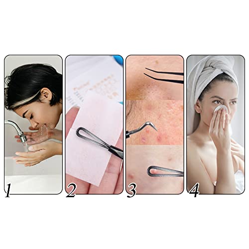 Justmysport Extractor de Puntos Negros Aguja Exacdor Limpiador Juego de 11 piezas Herramientas para Remover Acné Comedones BlackHead Extractor