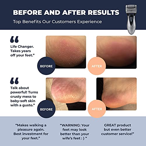 Lima-Electrónica para el Cuidado de los Pies de Hombres Own Harmony - Profesional y Poderoso - Recargables Aparato de Pedicura Eléctrico con 3 Diamond Rodillos - Elimina Piel Seca y Endurecida
