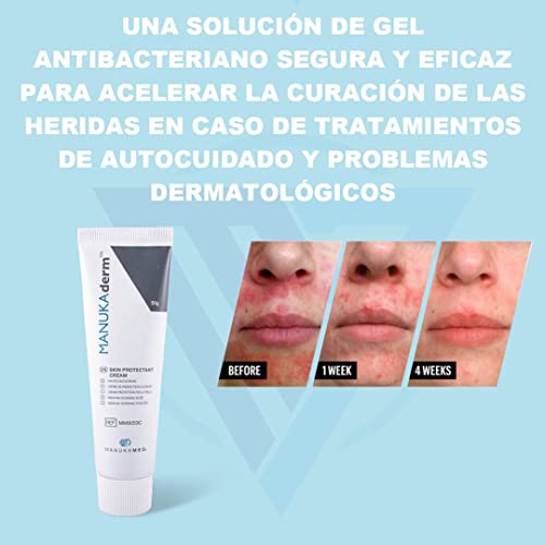 ManukaMed Crema de miel Derm Manuka para psoriasis, neurodermitis, pomada, eccema y psoriasis, crema de acné, 50 g