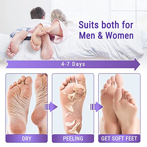 Mascarilla Exfoliante Pies 5Pcs, Lavanda Exfoliantes Calcetines Exfoliante Pies, Máscara Pies, Eliminar Piel Muerta Foot Peeling Mask Hidratant, Repara Sequedad, Grietas y Callosidades, Foot Mask