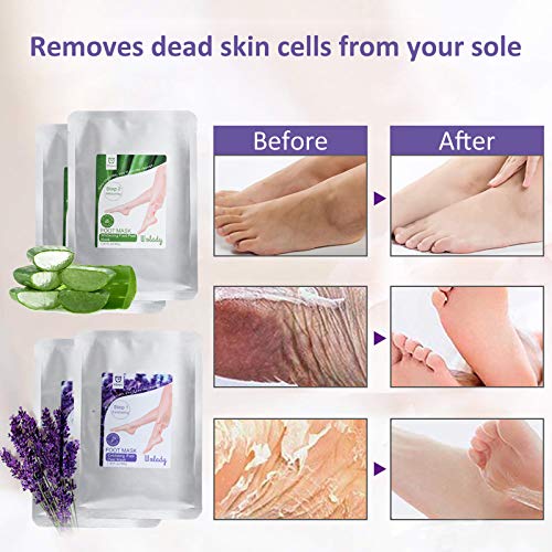 Mascarilla Pies Exfoliante Máscara Wolady 4pcs Exfoliantes Calcetines Exfoliante Pies Máscara Pies Foot Mask, Quita Cutículas y Callos, Eliminar Piel Muerta Foot Peeling Mask Hidratante y Blanqueadora